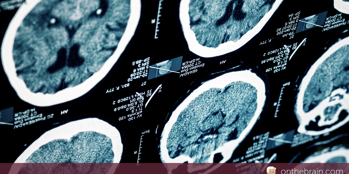 田仲真治「Brain Update」 fnins-15-799761-g001.jpg